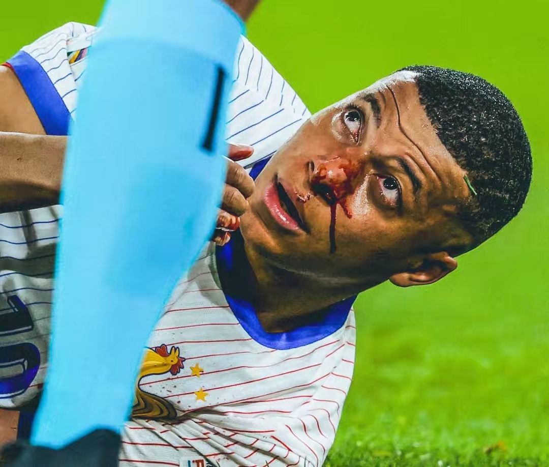 实力强队遭遇阻碍,难以取得胜利 实力强队遭遇阻碍,难以取得胜利